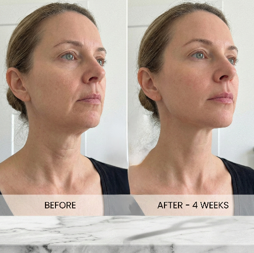 4-in-1 Red Light Therapy V-Face Roller